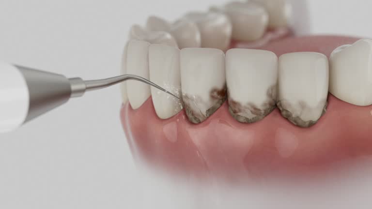 Reliable Emergency Dentist contractor in Fords, NJ by Smile Center Dentistry